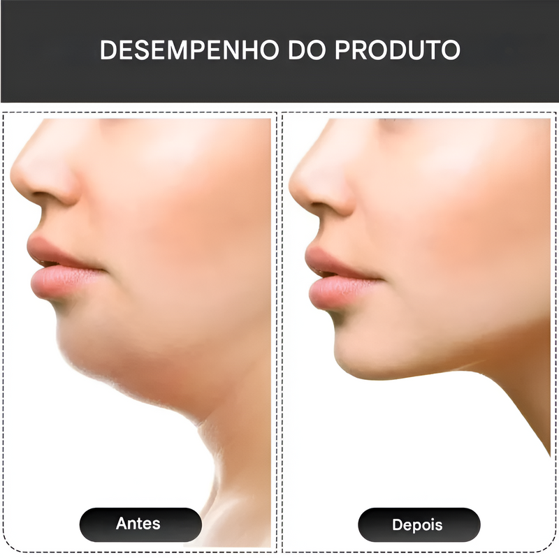 Exercitador Facial de Maxilar – Defina o Maxilar e Fortaleça a Mandíbula Naturalmente
